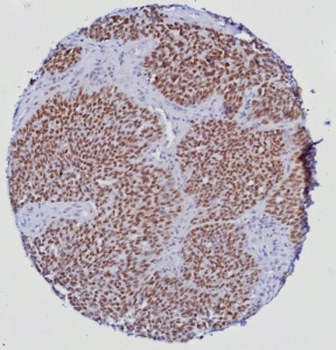 ERG Antibody / Transcriptional regulator ERG
