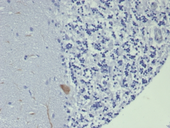 GIRK2 Antibody / KCNJ6