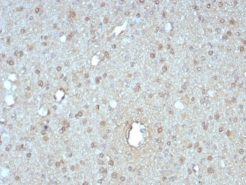 GIRK2 Antibody / KCNJ6
