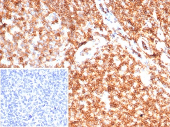 CD45 Antibody (Leukocyte marker)