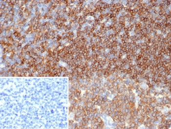 CD45 Antibody (Leukocyte marker)
