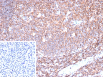 CD45 Antibody (Leukocyte marker)