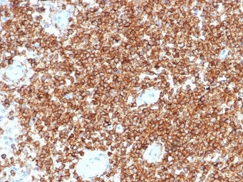 CD45RA Antibody (Leukocyte marker)
