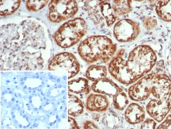 MR1 Antibody / MHC class I related protein 1