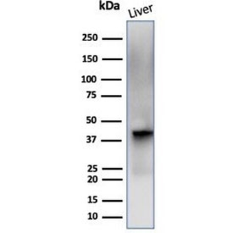Glutamine Synthetase Antibody / GLUL