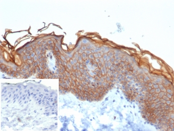 S100A16 Antibody