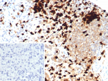 S100A9 Antibody / MRP14 / Calgranulin B / Calprotectin L1H