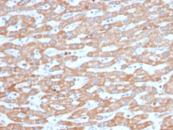 SDHB Antibody / Succinate dehydrogenase B