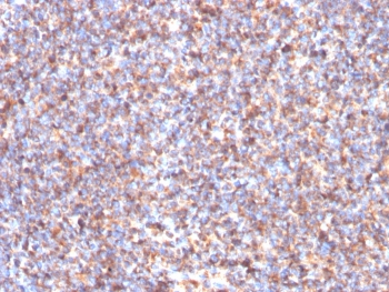 SDHB Antibody / Succinate dehydrogenase B