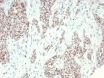 LSD1 Antibody / Lysine-Specific Demethylase 1