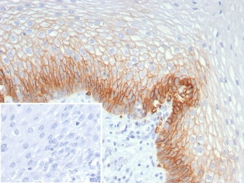 GLUT1 Antibody / SLC2A1