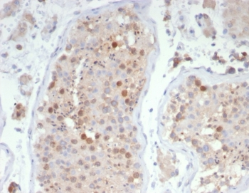 KIF2C Antibody / MCAK