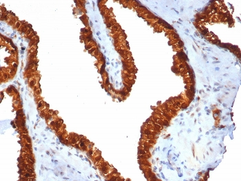 TROP2 Antibody / TACSTD2