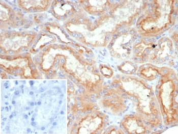 Leptin Receptor Antibody / LEPR