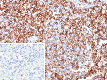 GBP1 Antibody / Guanylate binding protein 1