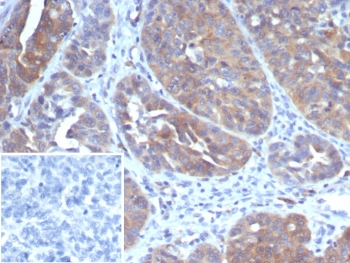 GCLM Antibody / Glutamate-Cysteine Ligase Regulatory Subunit