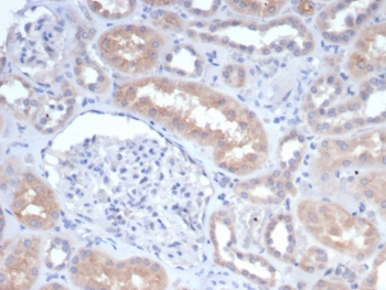 GCLM Antibody / Glutamate-Cysteine Ligase Regulatory Subunit
