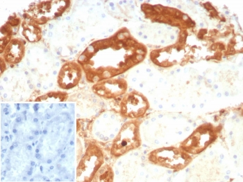 GSTM3 Antibody / Glutathione S-Transferase mu 3