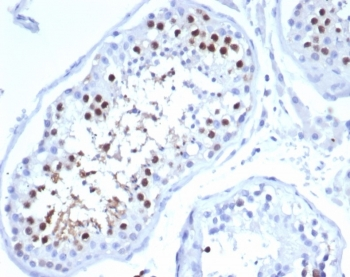 KIF2C Antibody / MCAK