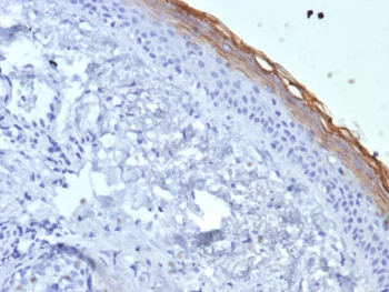 Kallikrein 7 Antibody / KLK7