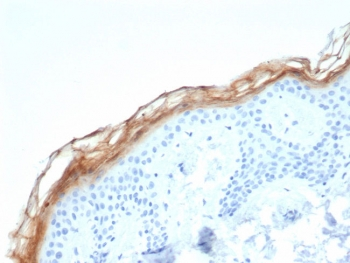 Kallikrein 7 Antibody / KLK7