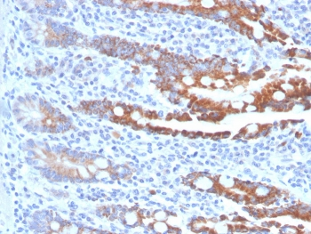 CEACAM1 Antibody / BGP-1