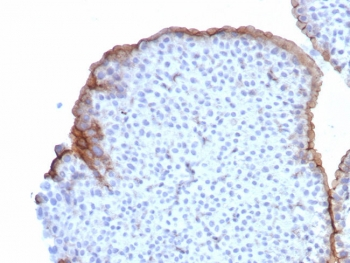 Uroplakin 3B Antibody / UPK3B