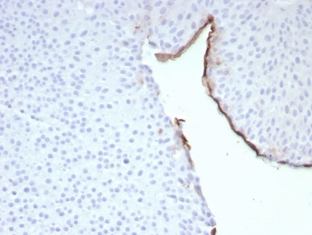 Uroplakin 3B Antibody / UPK3B