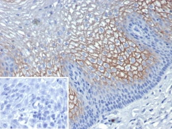 SBSN Antibody / Suprabasin