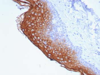 SBSN Antibody / Suprabasin