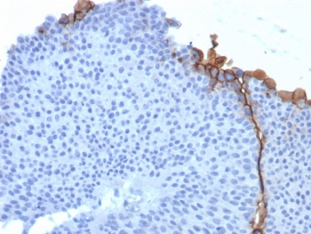 Uroplakin 3B Antibody / UPK3B