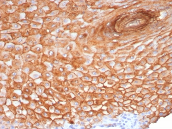 SBSN Antibody / Suprabasin