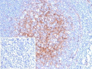 ICAM1 Antibody / CD54