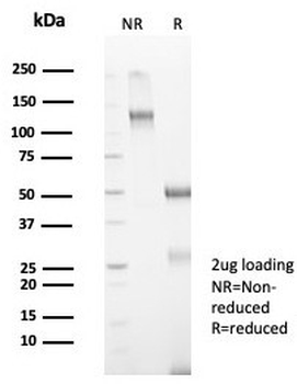 AMH Antibody / Anti-Muellerian Hormone