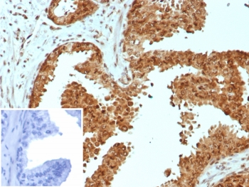 CARM1 Antibody / PRMT4