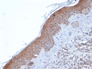 SERPINB5 Antibody / MASPIN