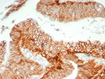 CD147 / Emmprin / Basigin Antibody