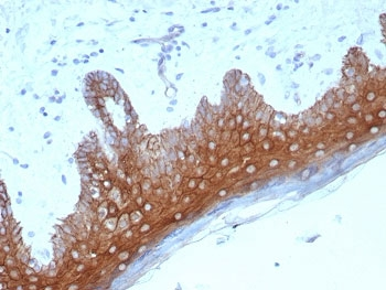 Desmoglein 1 Antibody / DSG1