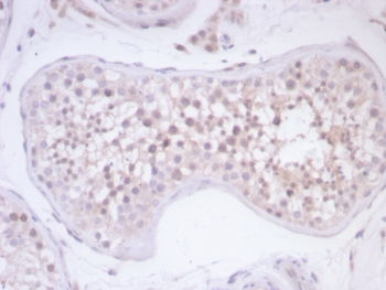 Survivin Antibody / BIRC5