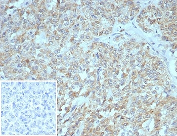 SSTR2 Antibody / Somatostatin Receptor 2