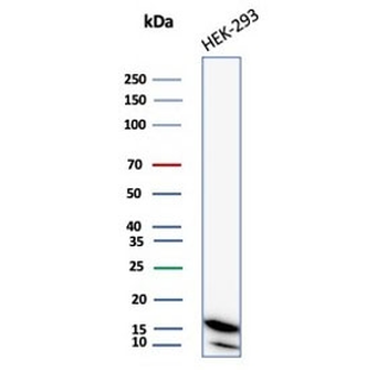 NME2 Antibody / Nucleoside diphosphate kinase B / NDKB