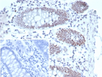 T-bet Antibody / Tbox-bet / TBX21