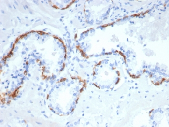 Cytokeratin 14 Antibody / CK14 / KRT14