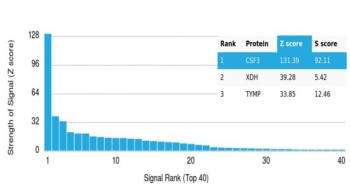 CSF3 Antibody / Granulocyte-Colony Stimulating Factor