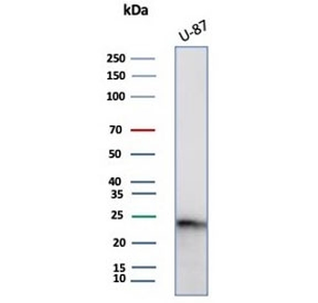 CSF3 Antibody / Granulocyte-Colony Stimulating Factor