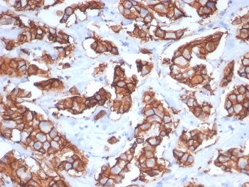 HER2 Antibody / ErbB2