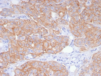 HER2 Antibody / ErbB2