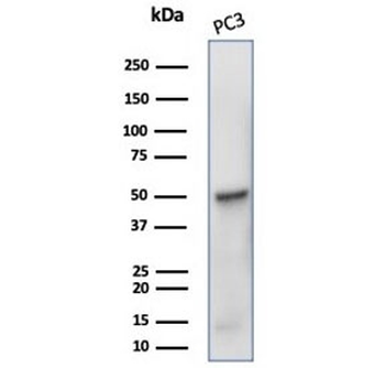 Beta Tubulin Antibody / TUBB3