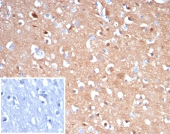 Beta Tubulin Antibody / TUBB3