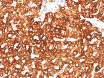 Haptoglobin Antibody